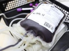 Rezerve krvi u Srbiji na minimalnom nivou, odlažu se planirane operacije